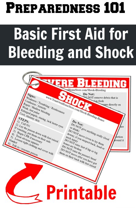 Printable first aid reminder cards for severe bleeding and shock.