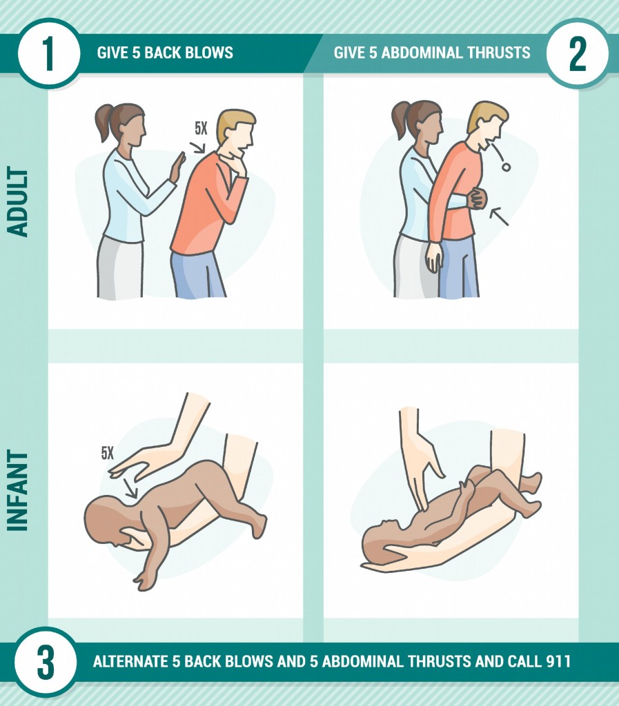 Choking Aid Guide for Adult and Infants