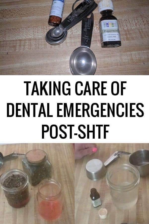 dental emergencies pinterest