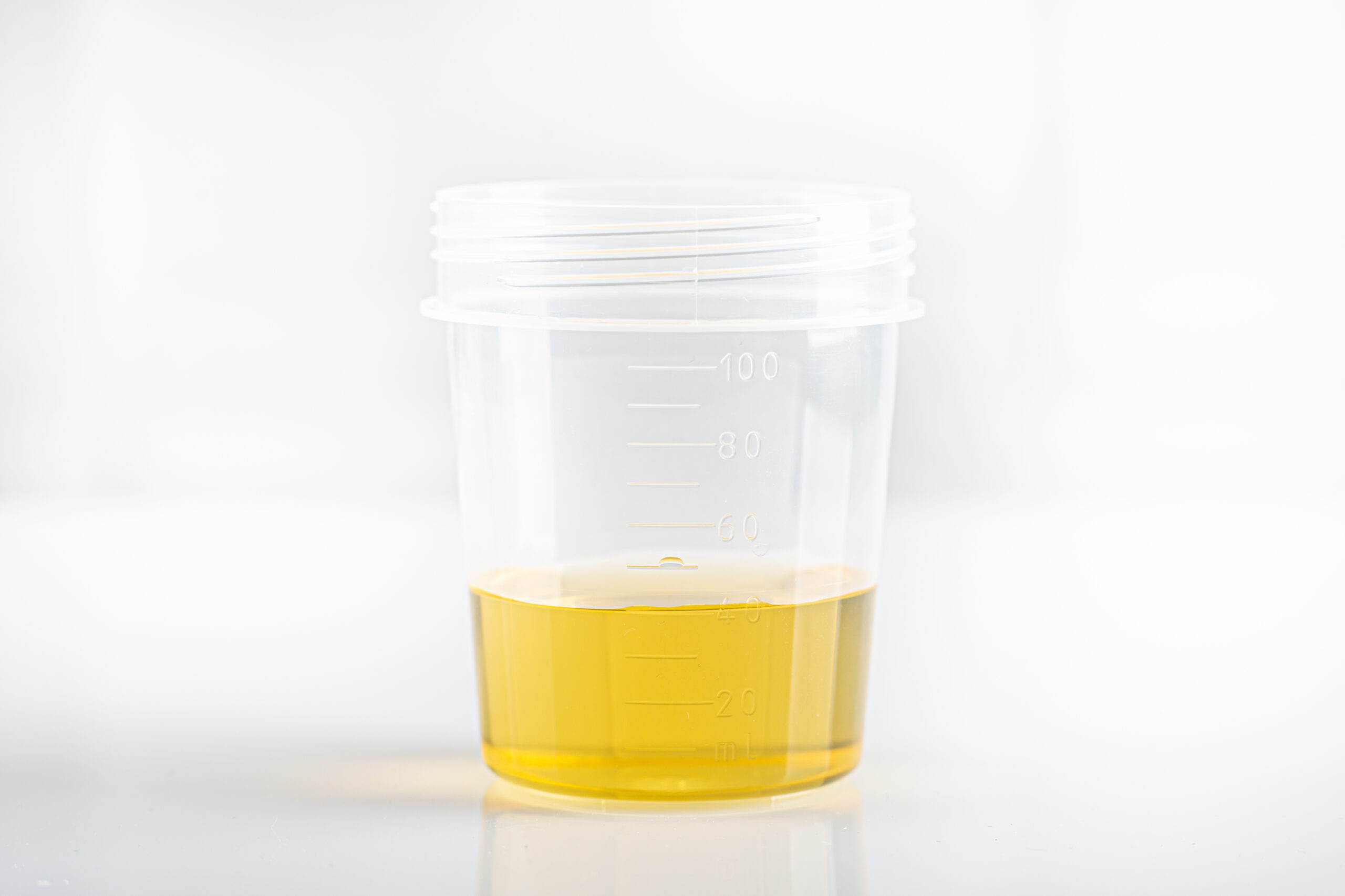 cup of urine