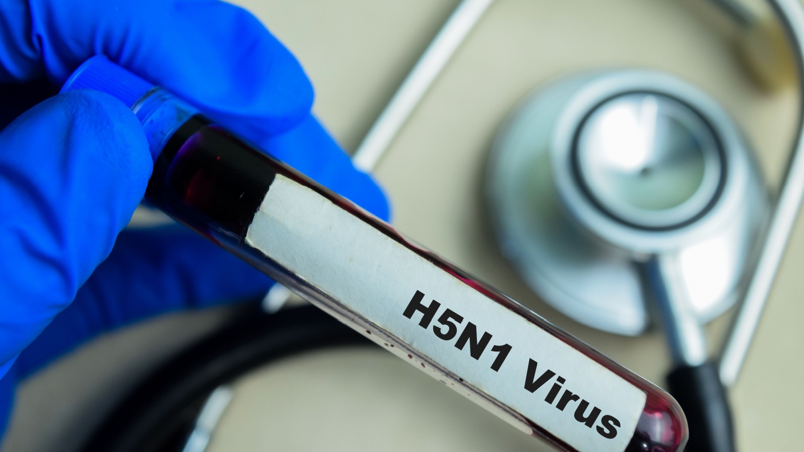 H5N1 Virus - Test with blood sample on wooden background. Healthcare or medical concept